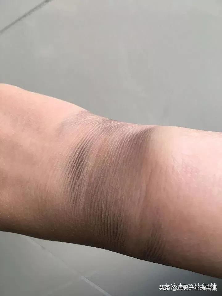 戴银镯手脖发黑了,戴银镯发黑是什么原因