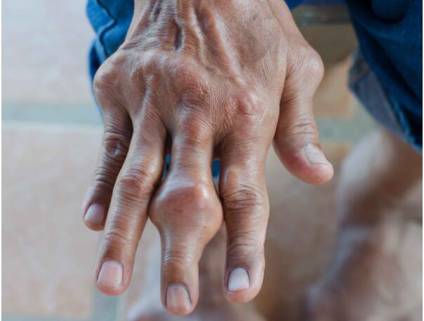 肺干不干净，看这3个地方！平时多吃3物，养护肺脏，避免疾病来袭