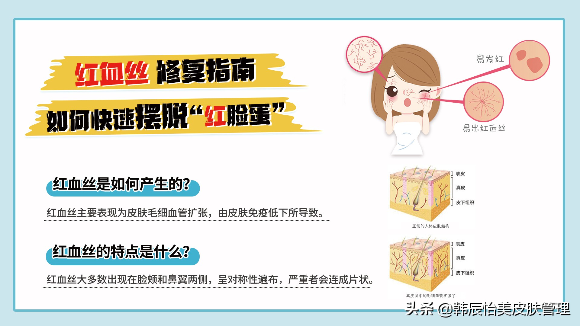 红血丝修复指南快速摆脱红脸蛋,红血丝修复的最快方法