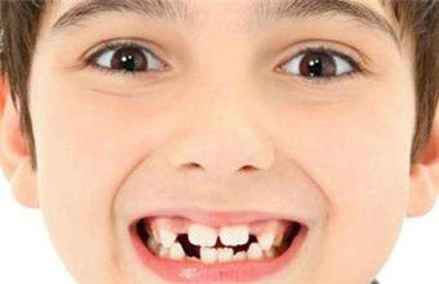 牙齿里出外进，一张嘴以为是海鱼……这都是你小时候换牙惹的祸！