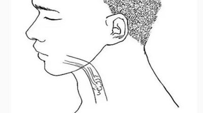 牙疼时拔牙对身体的危害,牙疼拔牙会出现什么严重后果