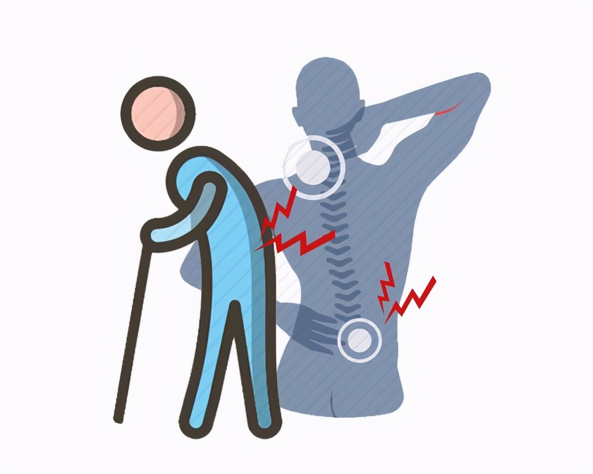 闪了腰有什么症状,不小心闪到腰需要治疗吗