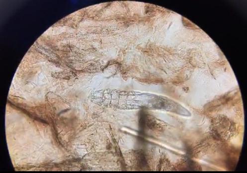 犬蠕形螨怎么治疗,犬蠕形螨和疥螨的区别