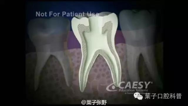 上牙龈上火突出一个鼓包,牙龈肿胀鼓包上火了吗