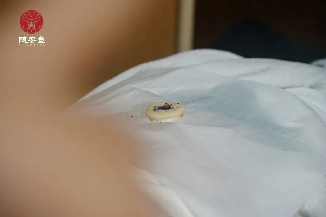 白天疲累，晚上咳嗽，阳虚体质如何调养