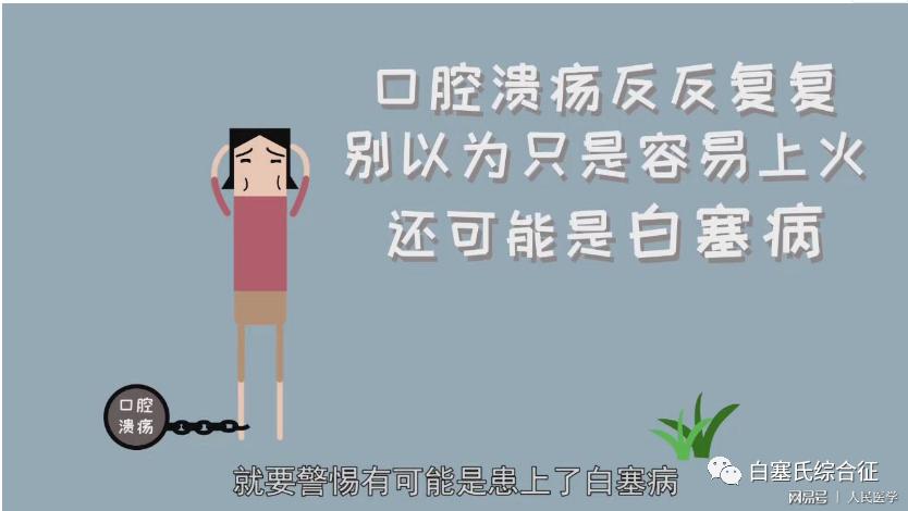 白塞病的症状有哪些,白塞病的口腔溃疡是什么样子