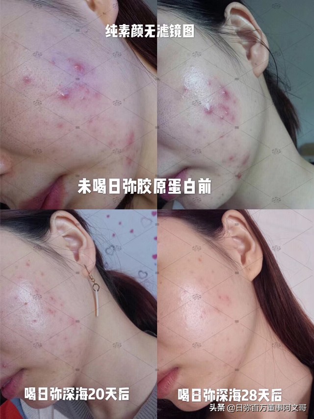 日弥nimi品牌怎么样,日弥深海胶原蛋白成分