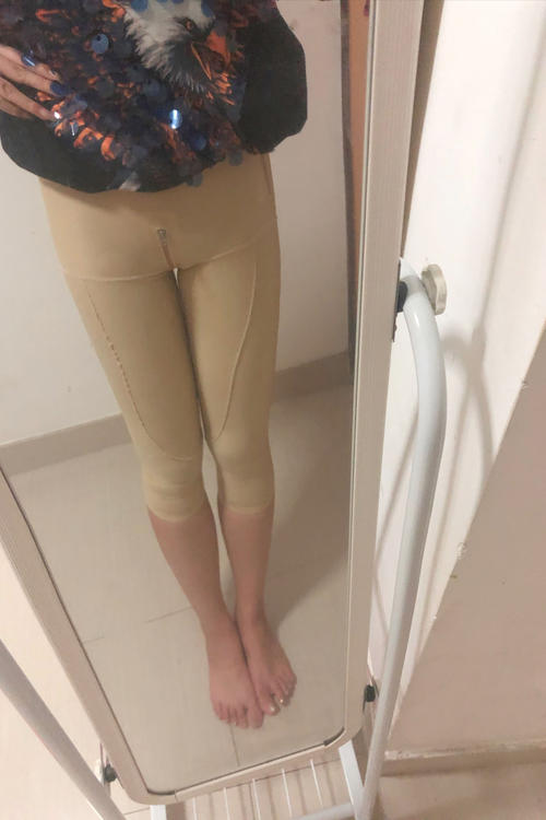 哪种吸脂不需要穿塑身衣,吸脂后穿塑身衣才有效果