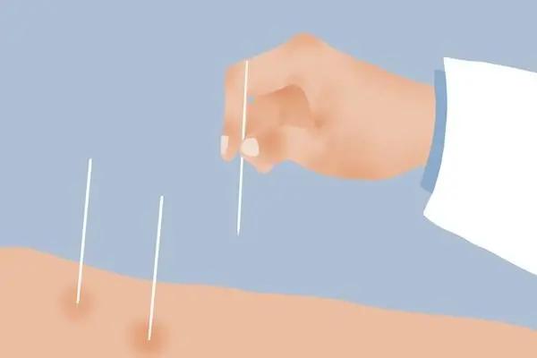 有患者说中医治疗对癌症没效果?多年老中医,用事实给出答案