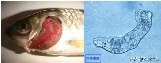 寄生虫多达6000条这种东西别乱吃,寄生虫的典型症状和表现