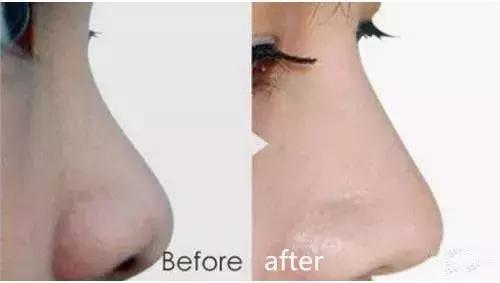 化妆真的能完全遮住瑕疵吗,化妆也掩盖不了岁月的痕迹