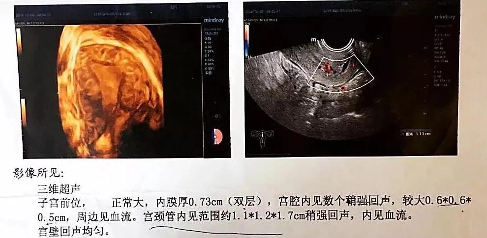 冬病夏治能治好哪些病,冬病夏治有效果没