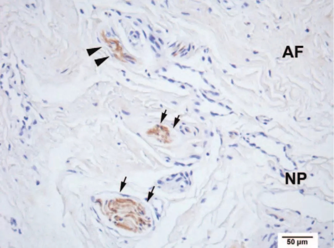 治疗颈椎病引起的眩晕用什么药方,颈椎病眩晕症最好的解决方法