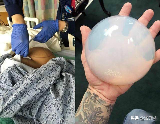 做了上百次整容不敢张嘴,做了2次手术都失败了