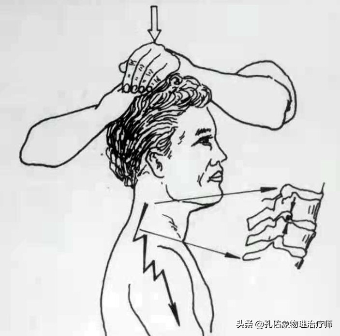 什么原因引起肩周炎手臂活动受限,引起肩周炎疼痛是什么原因