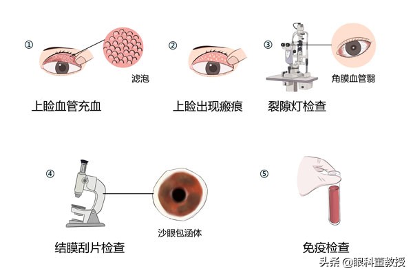 结膜炎跟沙眼有什么区别,沙眼和结膜炎有区别没有