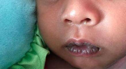 最美的嘴唇长什么样,世界上最好看的嘴唇是什么样的