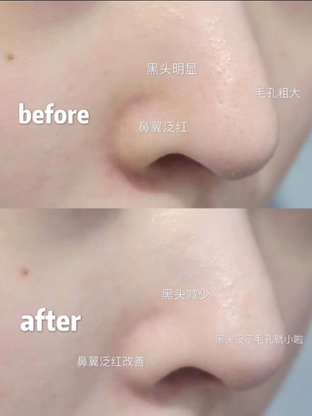 科颜氏的产品怎么样,科颜氏必买产品