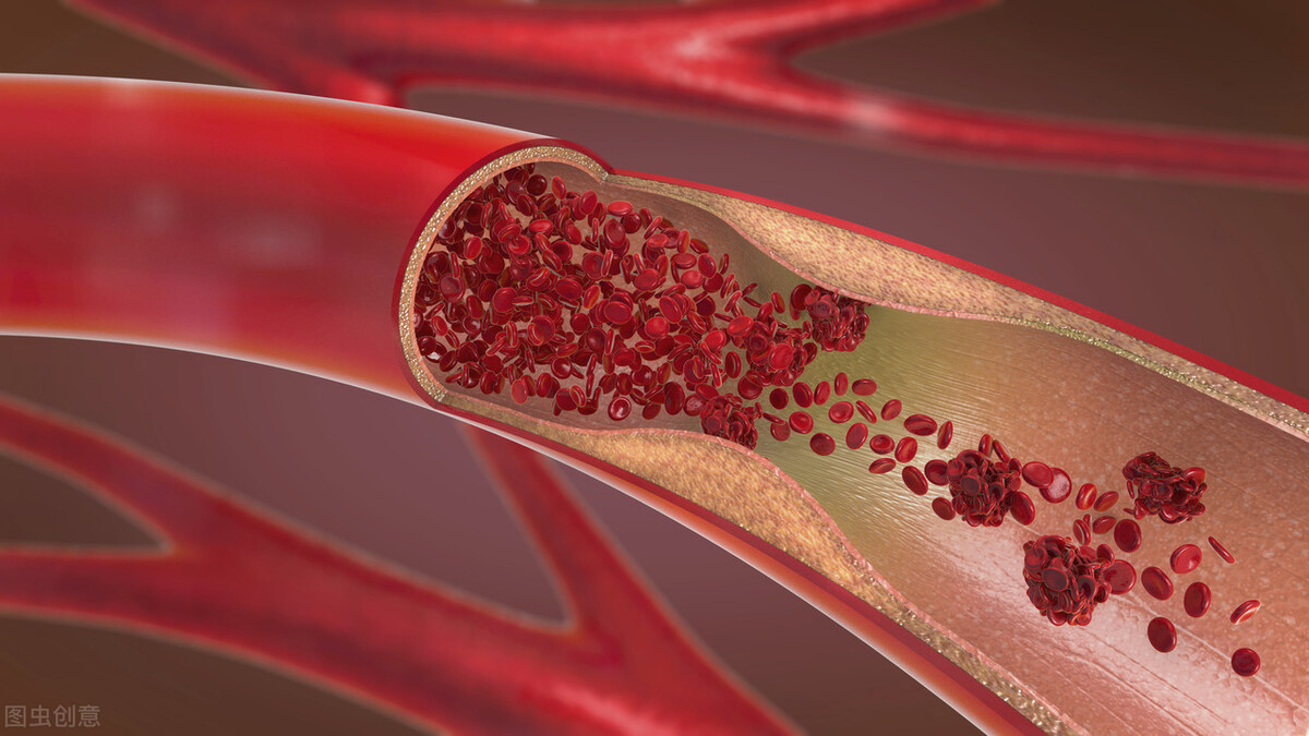 心脑血管疾病的“冠军药”，你都清楚吗？医生列详细，值得收藏