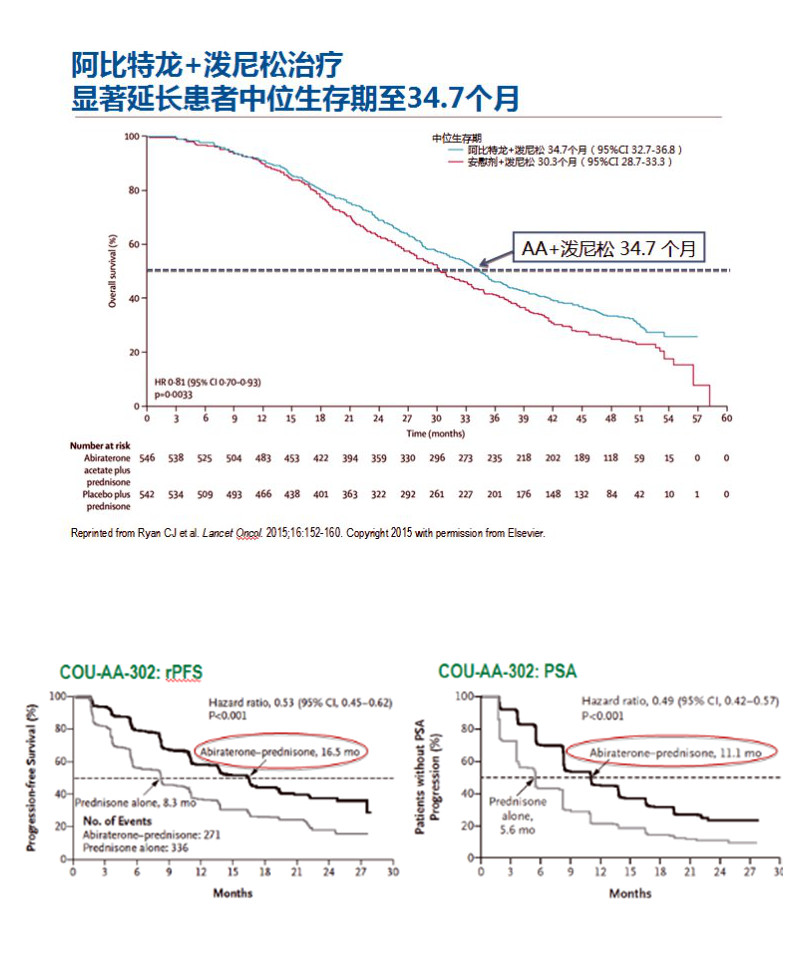 前列腺癌晚期对阿比特龙不敏感,前列腺癌阿比特龙泼尼松