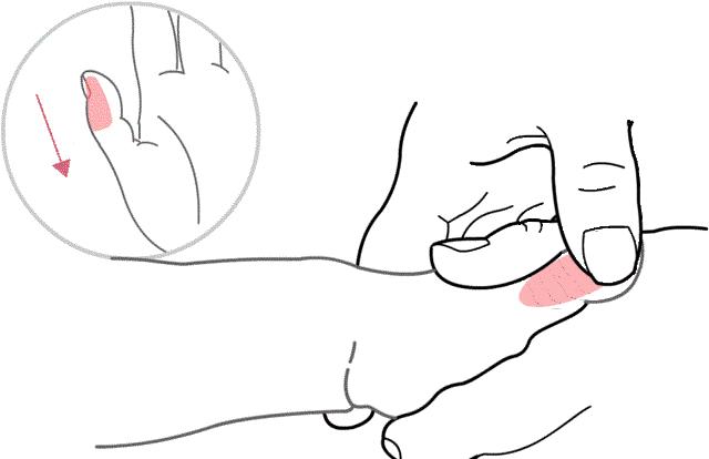 孩子便便有残渣,便便有食物残渣