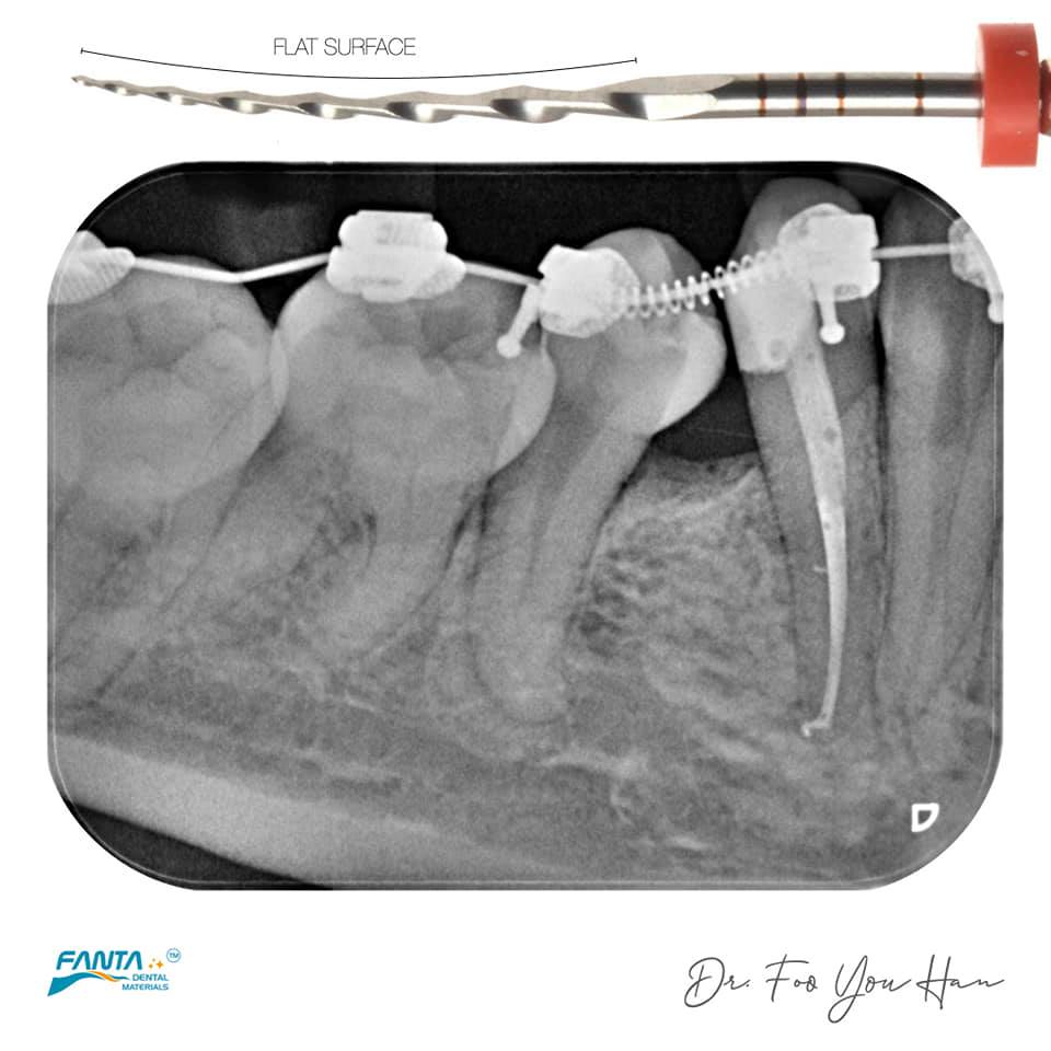 根管锉加工设备,益锐M3根管锉