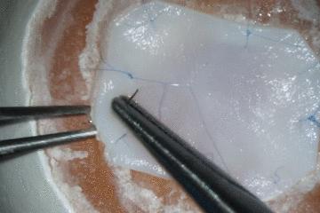 医学缝针练习,医生如何练习缝针