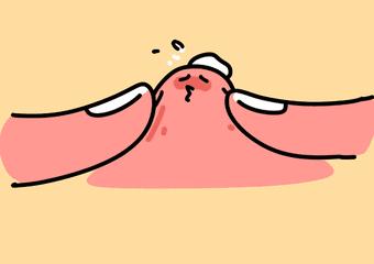 丁丁上怎么长了“小疙瘩、小红点”？难道是染上了性病？