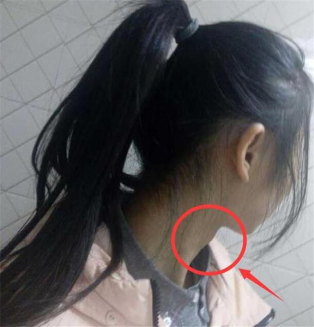 13岁女学生长喉结正常吗,12岁长出喉结胡子正常吗