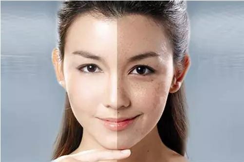 皮秒激光祛斑后怎么预防反黑,皮秒祛斑会反黑吗