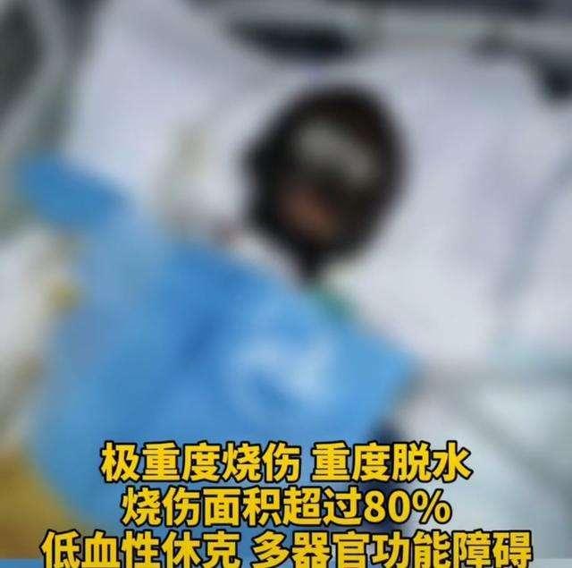 网红拉姆遭前夫纵火焚烧,网红拉姆遭前夫纵火现场