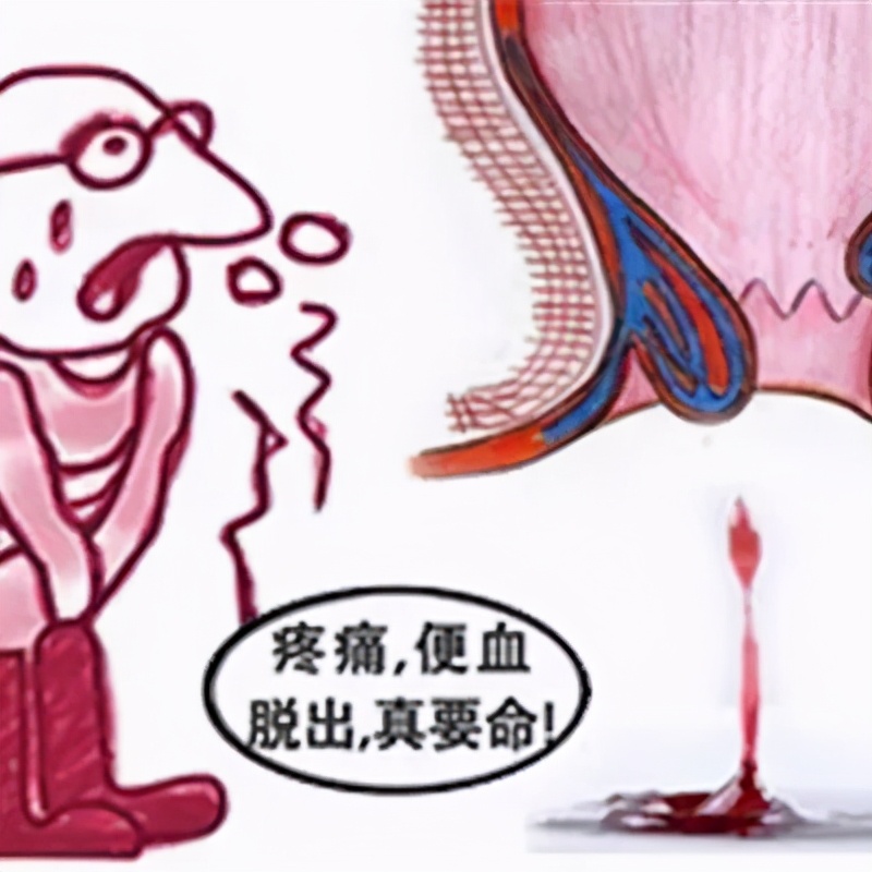 菊花根治肛肠病,菊花有修复术吗