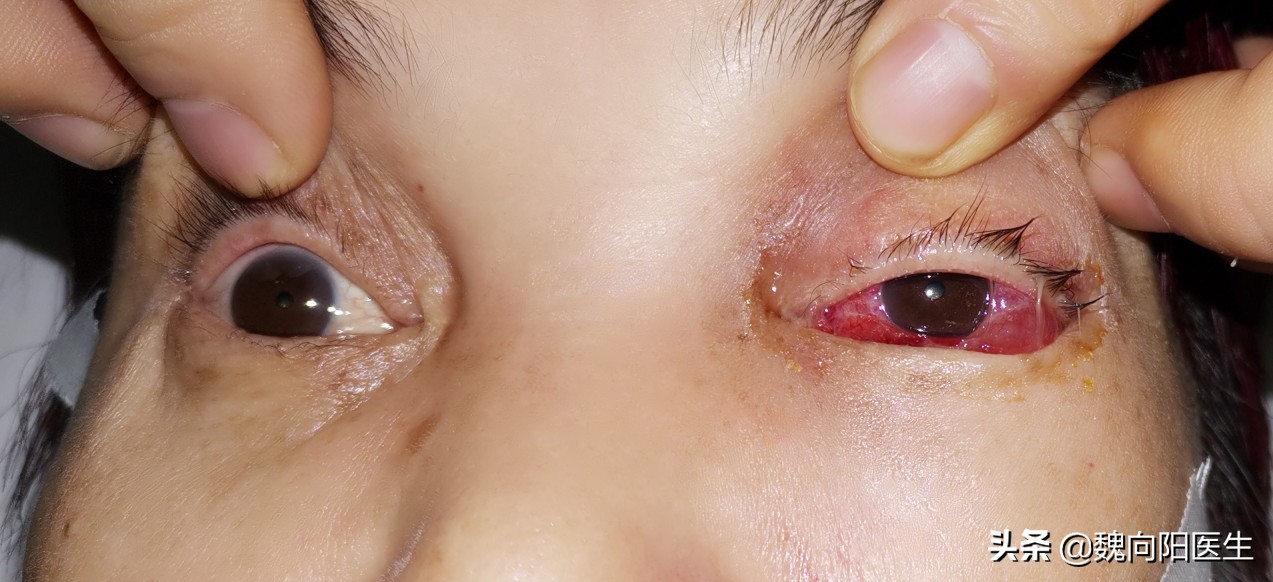 后脑勺着地可能出现什么症状,后脑勺着地算什么伤