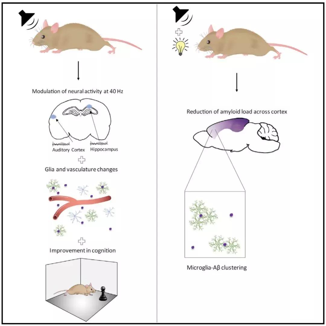 刺激大脑预防老年痴呆声音,十五赫兹音乐治疗老年痴呆症