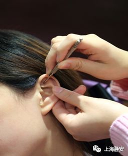 上海中医医院膏方专家,中医专家来店义诊