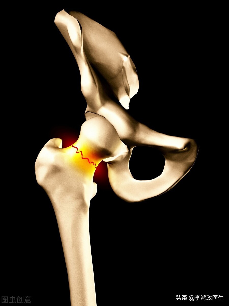 男子脚疼痛,男子脚扭伤疼痛难忍