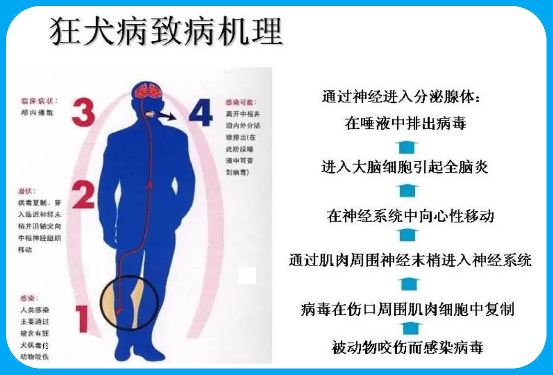 被狗咬有疯狗病吗,被疯狗咬后真的会像狗一样叫吗