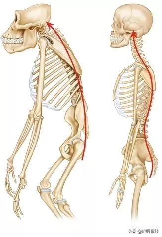 腰椎间盘突出手术后多久可以跑步,患了腰椎间盘突出还能跑步吗