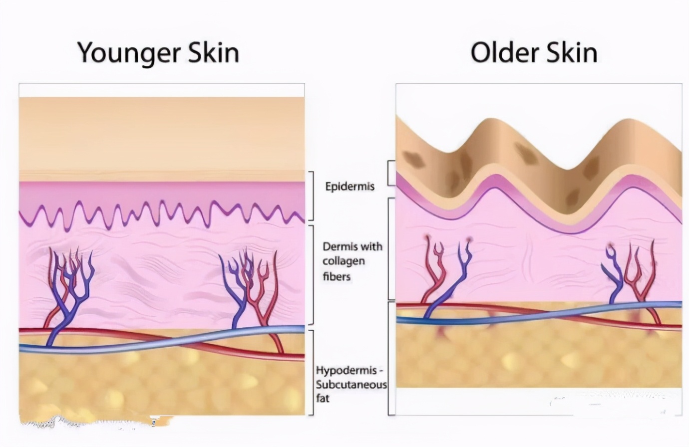 混干皮瑕疵皮毛孔粗大博主推荐,油皮瑕疵皮毛孔粗大