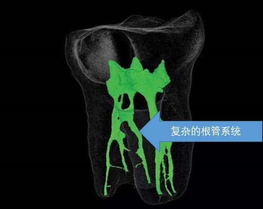 辟谣快速缓解牙疼,辟谣消炎药是抗生素