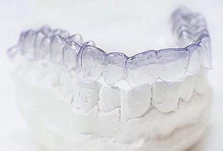 戴牙套遇到最大的牙齿问题,戴牙套必须要知道的事