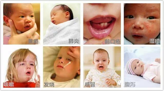 宝宝鹅口疮跟黄疸有关系吗,小孩母乳性黄疸湿疹