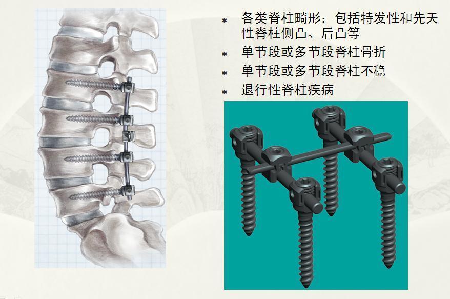 腰椎间盘突出针灸有副作用吗,腰椎间盘突出针灸越来越严重