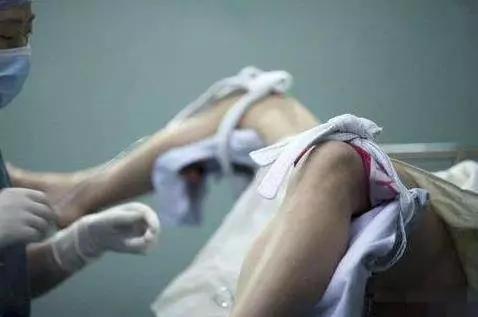 做了无痛人流手术后要注意什么,做了人流手术后应该注意保暖吗