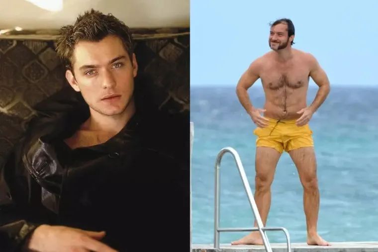 30岁脱发的男人正常吗,20岁男脱发有救吗