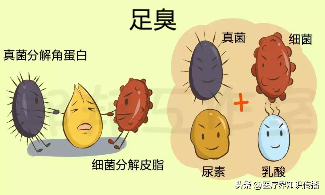 脚气引起的脚面溃烂肿胀怎么治愈,脚气用什么药膏可以彻底治愈