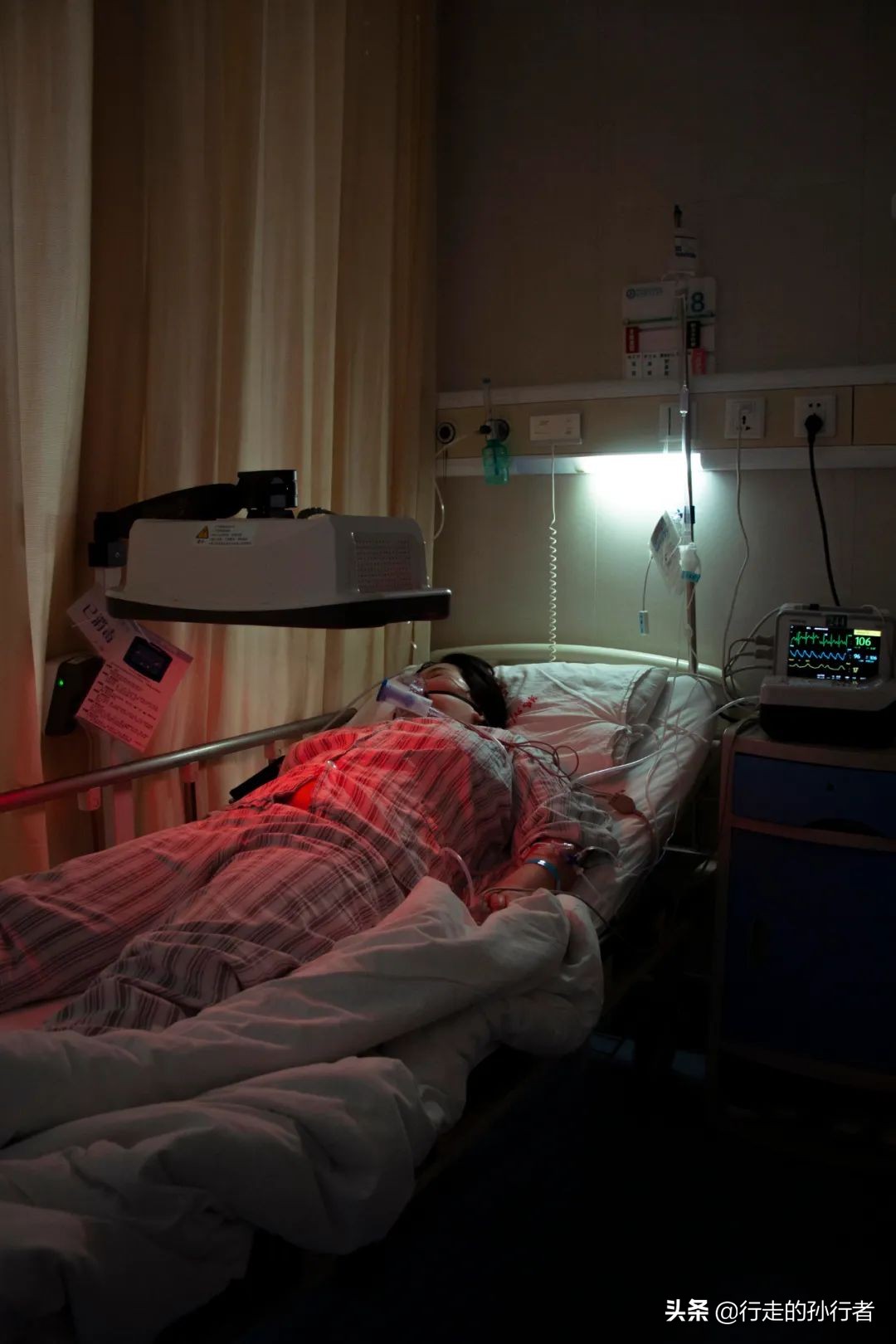 切胃减肥手术的副作用,为了减肥切胃到底值不值