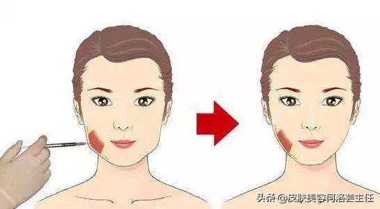 溶脂针一针能瘦身吗,瘦手臂溶脂针多少钱一针会反弹吗