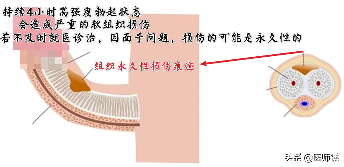 蓝色小药丸吃了多久起效,吃了蓝色药丸就有效吗