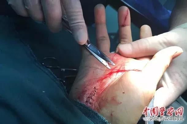 缉毒警被艾滋毒贩刺伤,警察抓艾滋毒贩